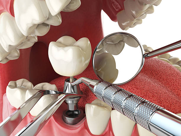 Best Emergency Dental Services for Seniors in New Kensington, PA